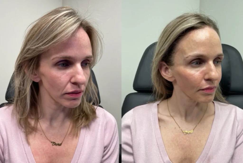 Aesthetic Treatments Park City